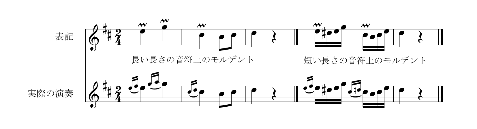 M. カルカッシ「ギターのための完全な教則本Op.59」45ページモルデント
